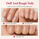 💅 50% dto. Relleno alisador para las estrías de las uñas – suaviza visualmente los surcos, acabado brillante natural y aplicación fácil con pincel. ¡Solo o como base! ✨🖌️